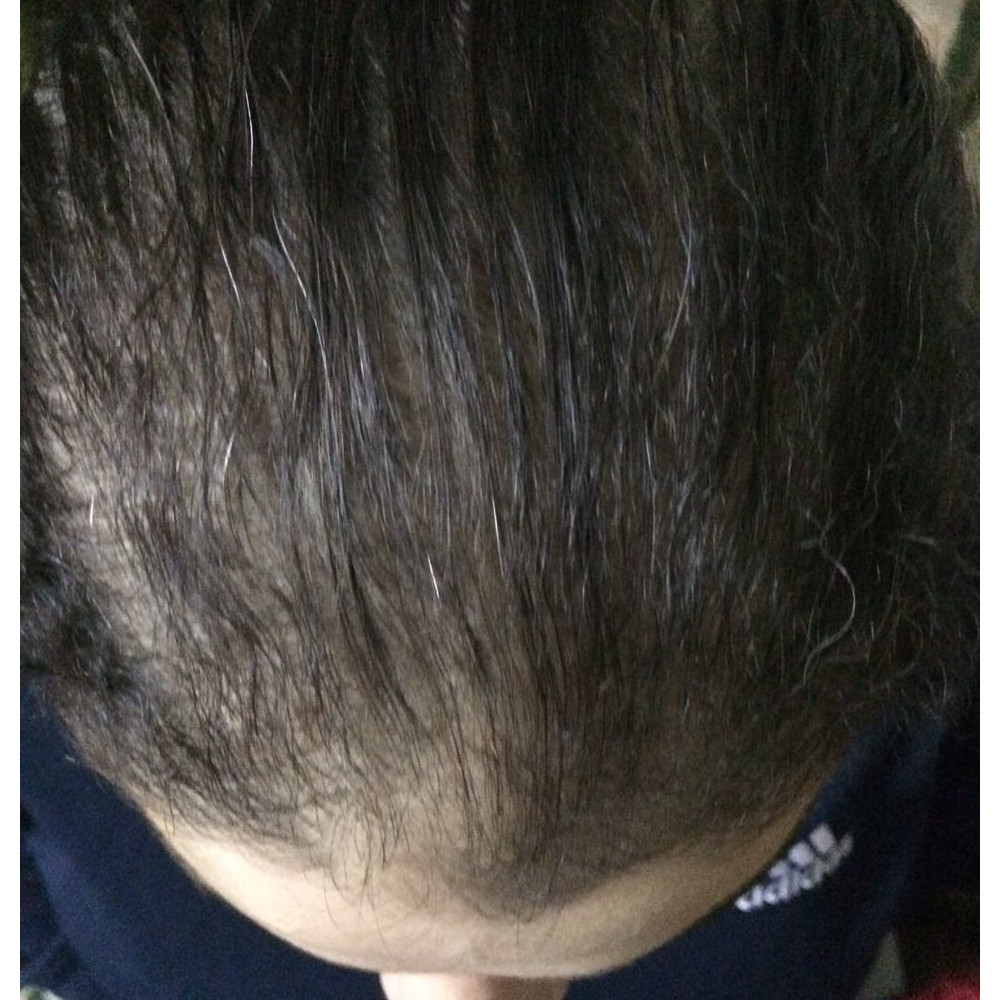 hair-package-3-179-web.png